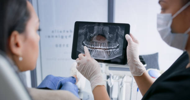 Licensed Teeth Whitening service in St. Augustine, FL - Smile Center Dentistry